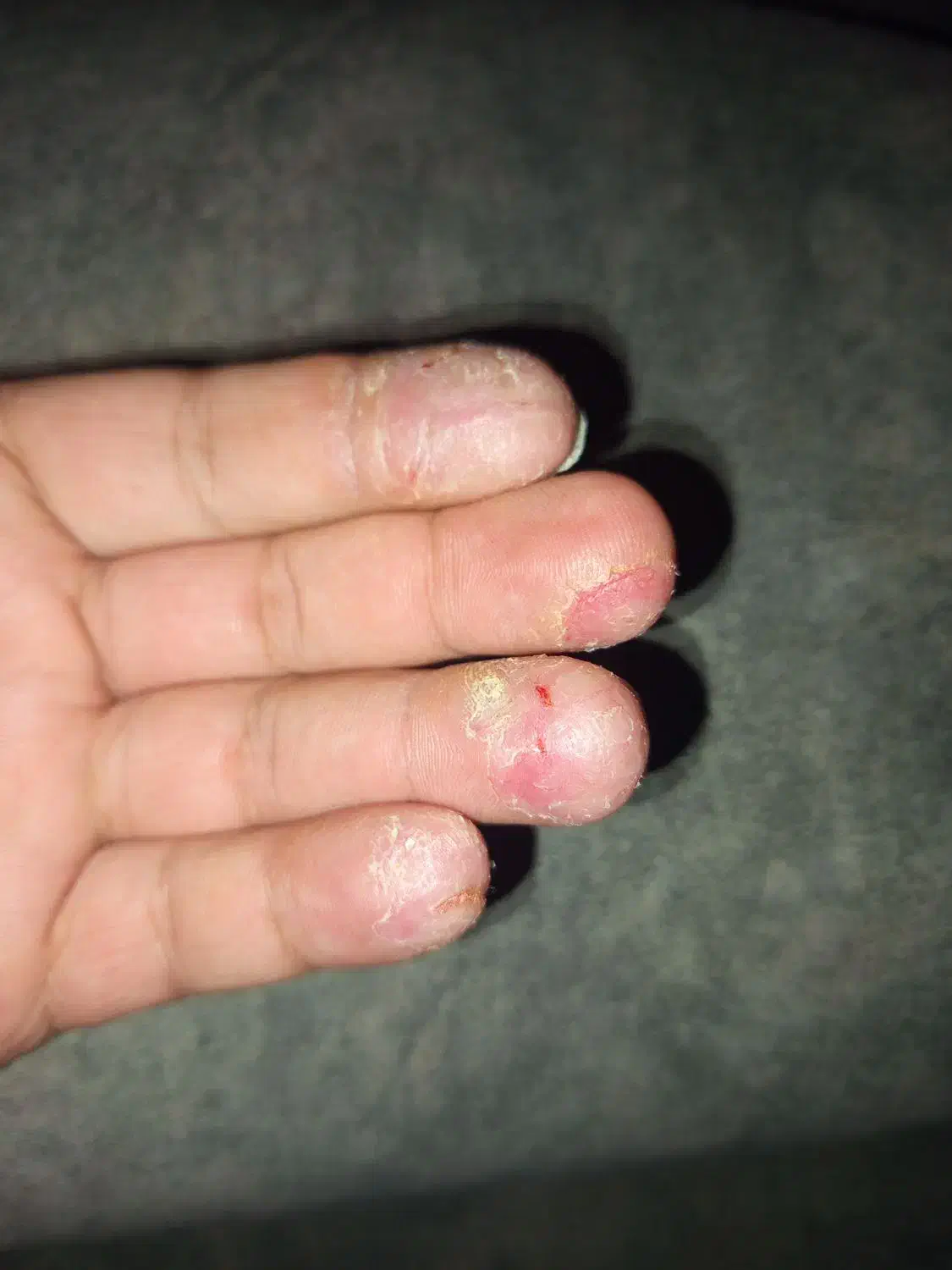 دکتر اگزما|فعالیت داوطلبانه تحقیقاتی|کرمان, |دیوار