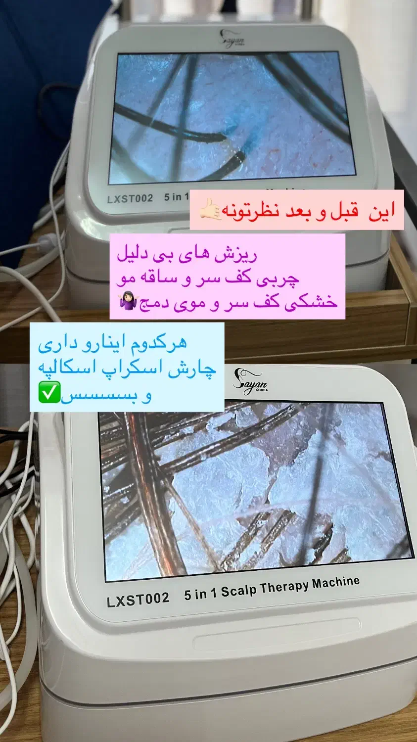 درمان قطعی شوره ،چربی،و انواع ریزش های مو|خدمات آرایشگری و زیبایی|اصفهان, چشمه باقرخان|دیوار