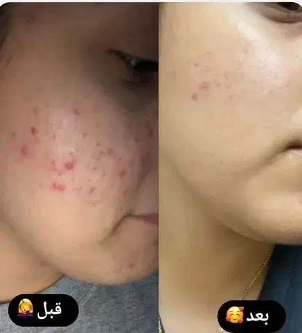 کرم ترمیم کننده گاتیو|آرایشی، بهداشتی، درمانی|تهران, تهرانسر غربی|دیوار