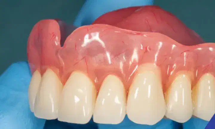 نصب دندان مصنوعی با شرایط شما|خدمات آرایشگری و زیبایی|پارس‌آباد, |دیوار