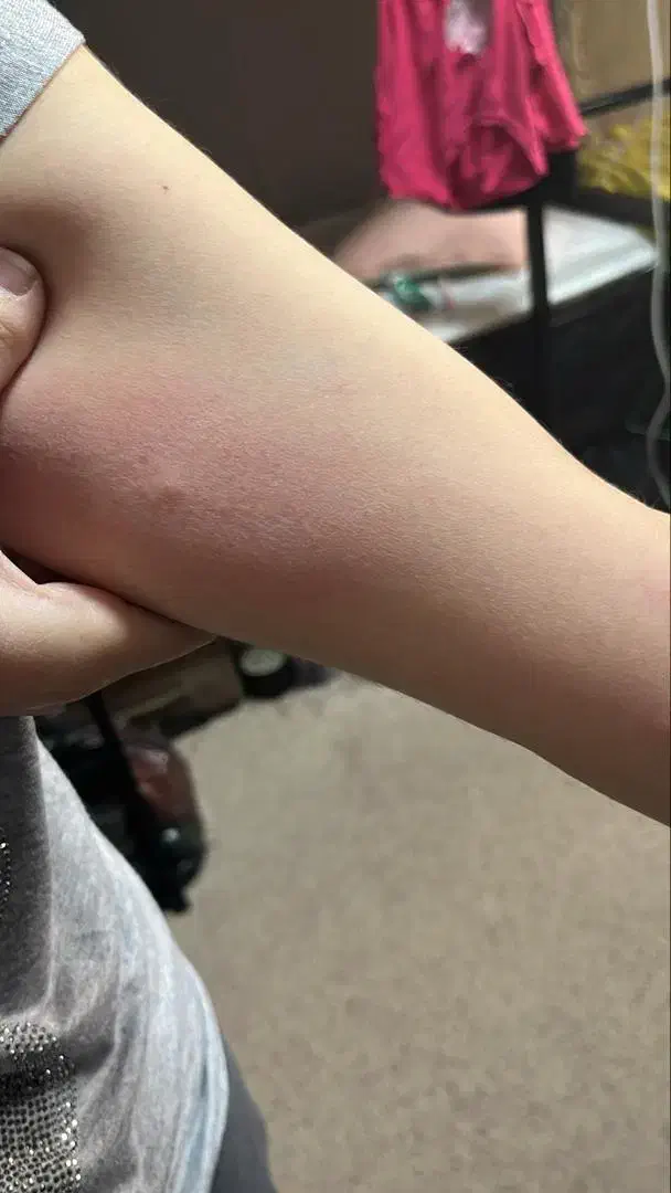 سمپاشی ساس تخصصی کارشناسی دقیق با نیروی متخصص|خدمات نظافت|تهران, صادقیه|دیوار