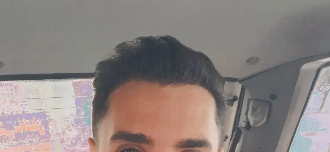 کاشت مو و ابرو قسطی در شیراز|خدمات آرایشگری و زیبایی|شیراز, قصرالدشت|دیوار