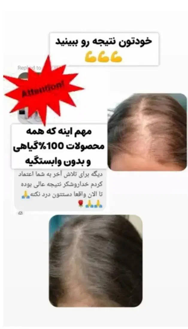 دفتر پخش تونیک هیرفرند بیز (اصلی) ضدریزش و رویش مو|آرایشی، بهداشتی، درمانی|مشهد, توس (بلوار توس)|دیوار