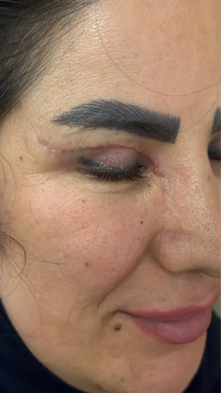 انواع جراحی های زیبایی صورت و بدن|خدمات آرایشگری و زیبایی|رشت, آتشگاه|دیوار