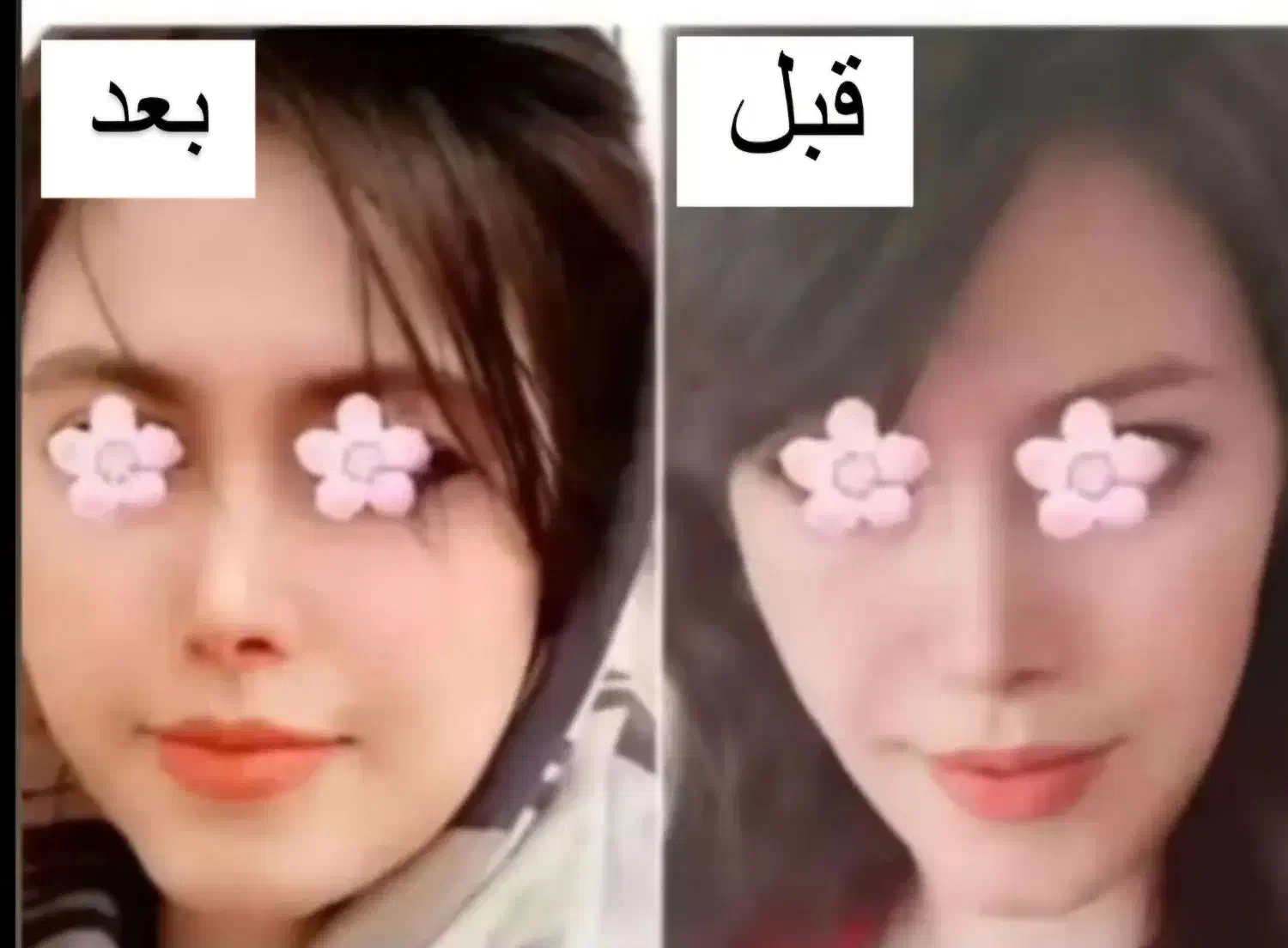 چاقی صورت و بدن تضمینی|خوردنی و آشامیدنی|طبس, |دیوار