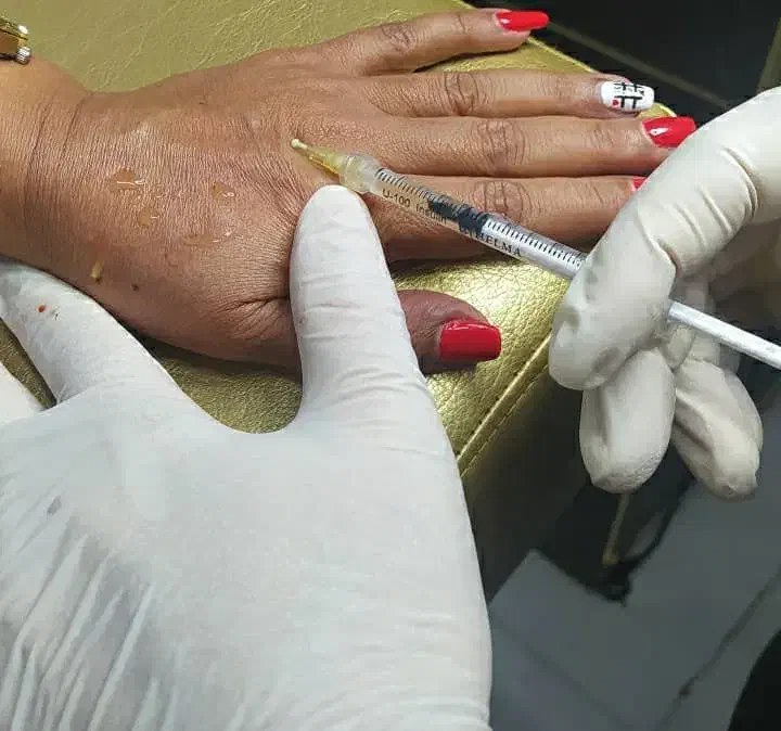 بوتاکس فیلر مزو نخ پی آر پی چربی جوانسازی بدون عمل|خدمات آرایشگری و زیبایی|کرج, گلشهر|دیوار