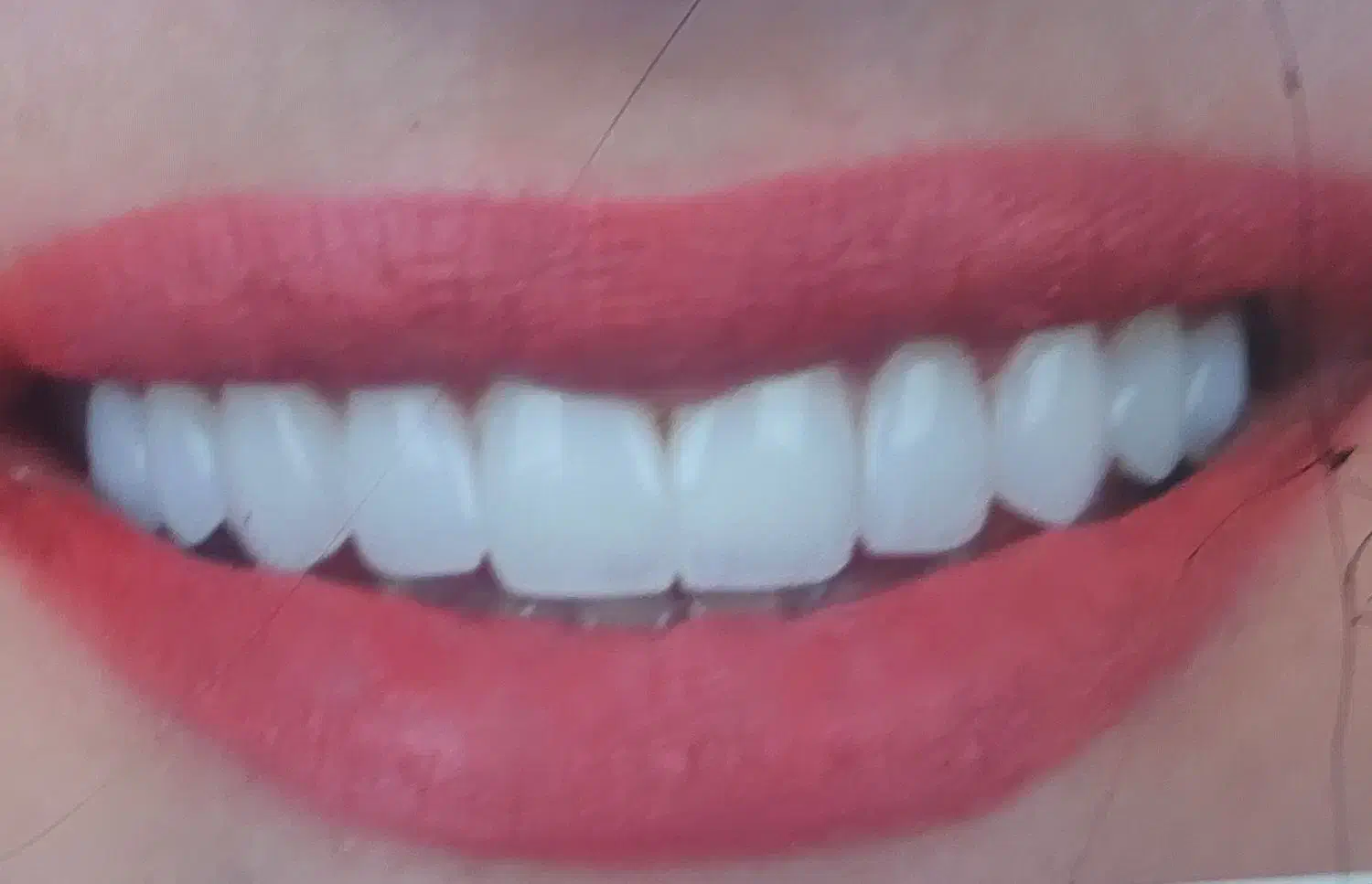 کارآموز دندانسازی|استخدام آموزشی|کرج, شهرک فهمیده|دیوار