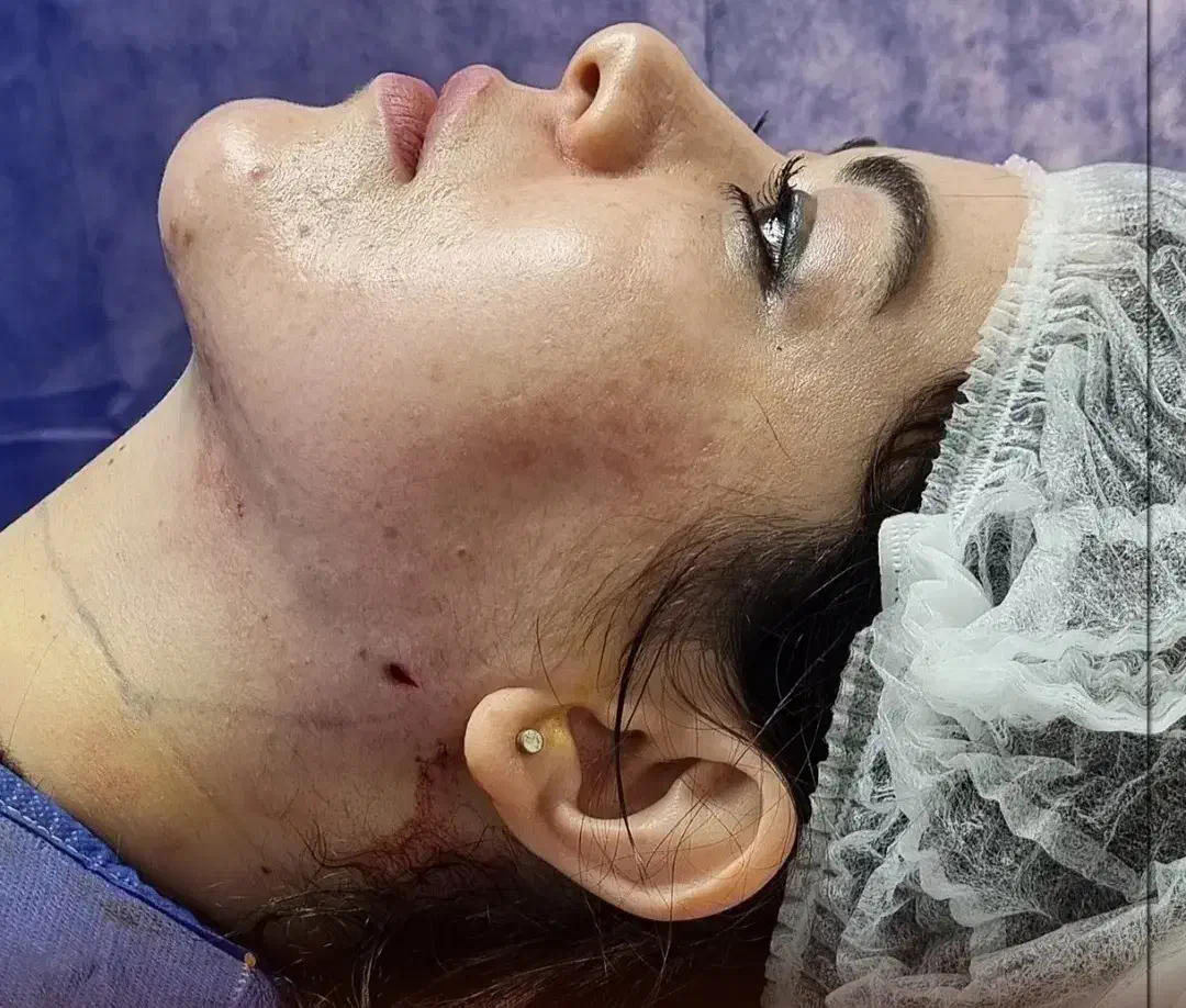 لیپوماتیک آبدو مینو پلاستی پروتز سینه شرایط اقساط|خدمات آرایشگری و زیبایی|تهران, بلوار کشاورز|دیوار