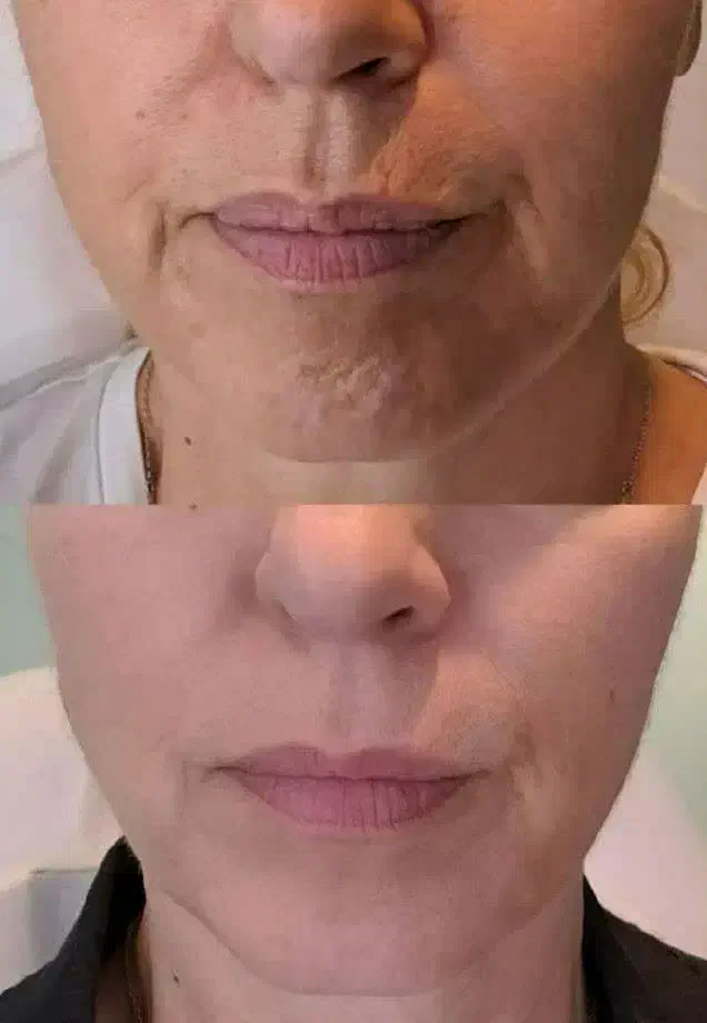 کرم بیوممتیک|آرایشی، بهداشتی، درمانی|تهران, دولاب|دیوار