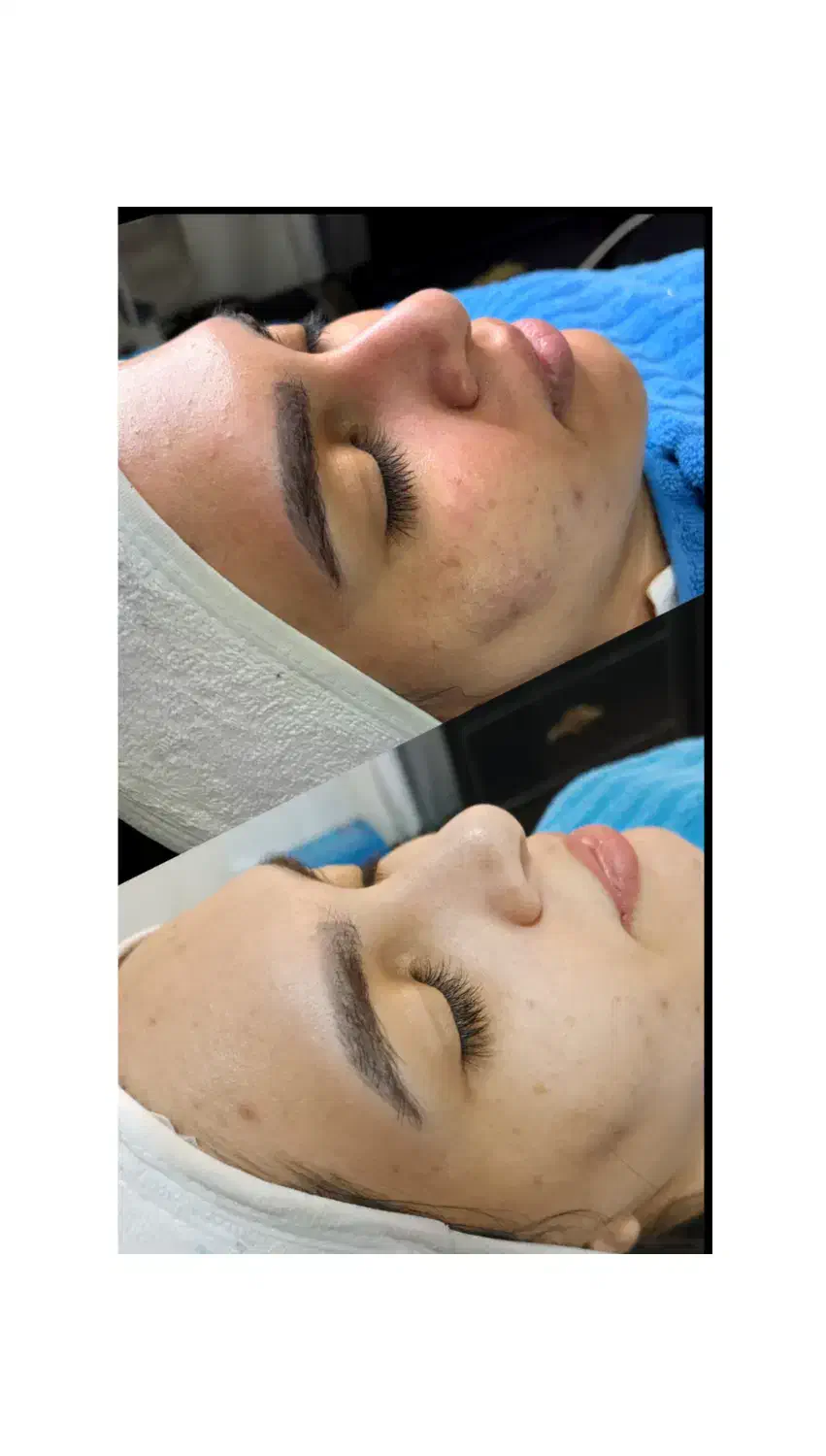 فیشیال پوست|خدمات آرایشگری و زیبایی|فلاورجان, |دیوار