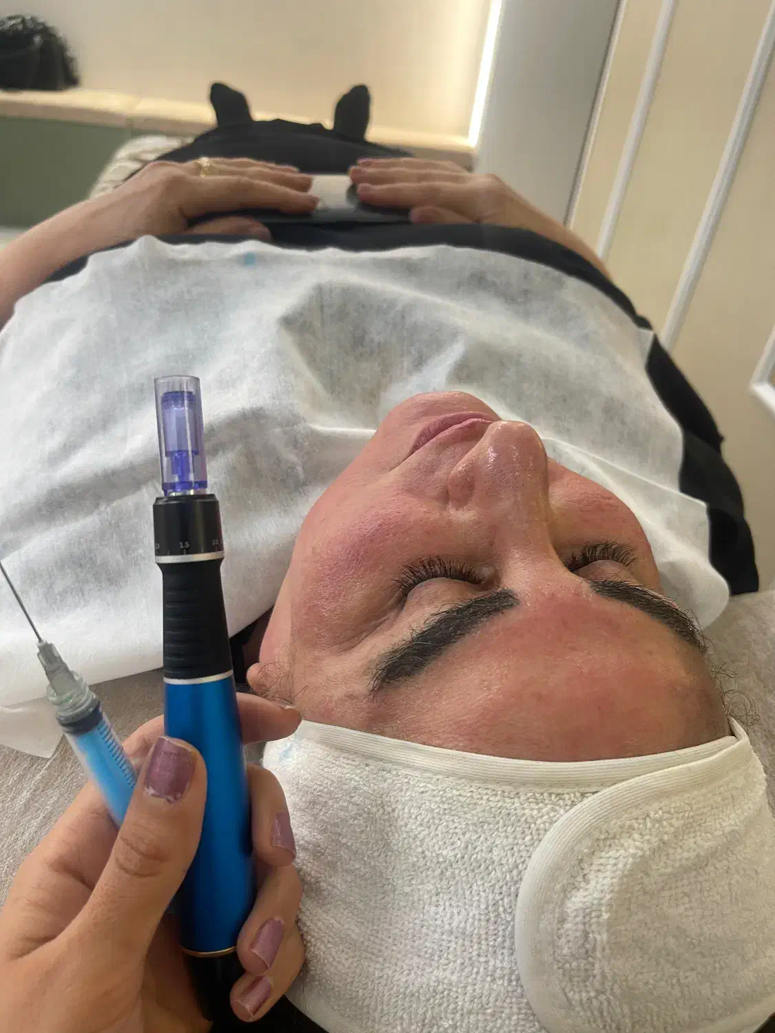 فیشال پاکسازی پوست|خدمات آرایشگری و زیبایی|محمدیه-قزوین, |دیوار