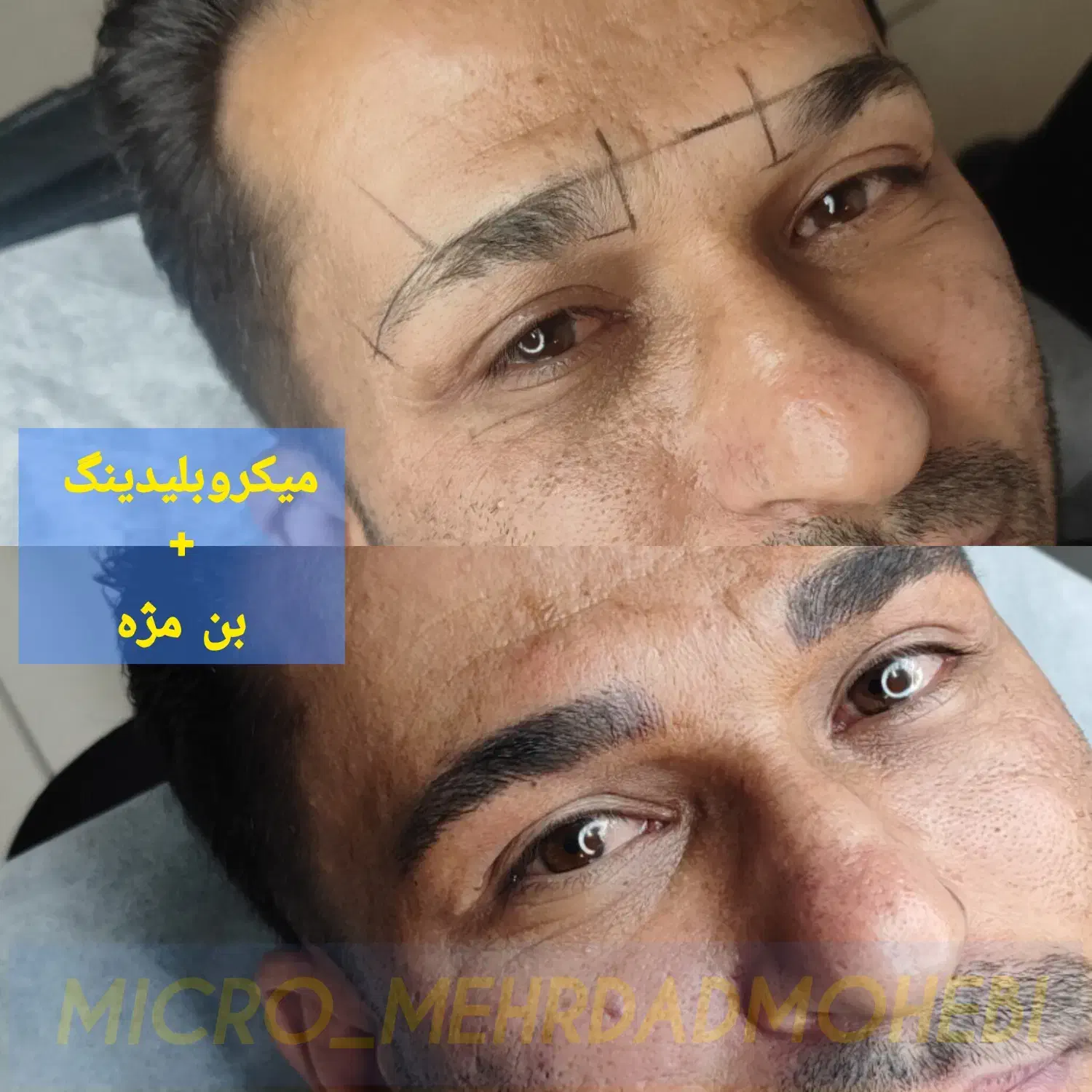 میکروبلیدینگ ابرو/رفع تیرگی لب/اسکالپ سر|خدمات آرایشگری و زیبایی|تهران, نیاوران|دیوار