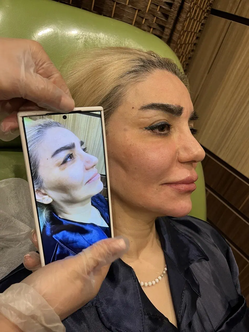 بوتاکس ،ژل لب ،لیزر،مزو ژل جوانساز،پلاسمای پلک|خدمات زیبایی و سلامت|تهران, سید خندان (جلفا)|دیوار
