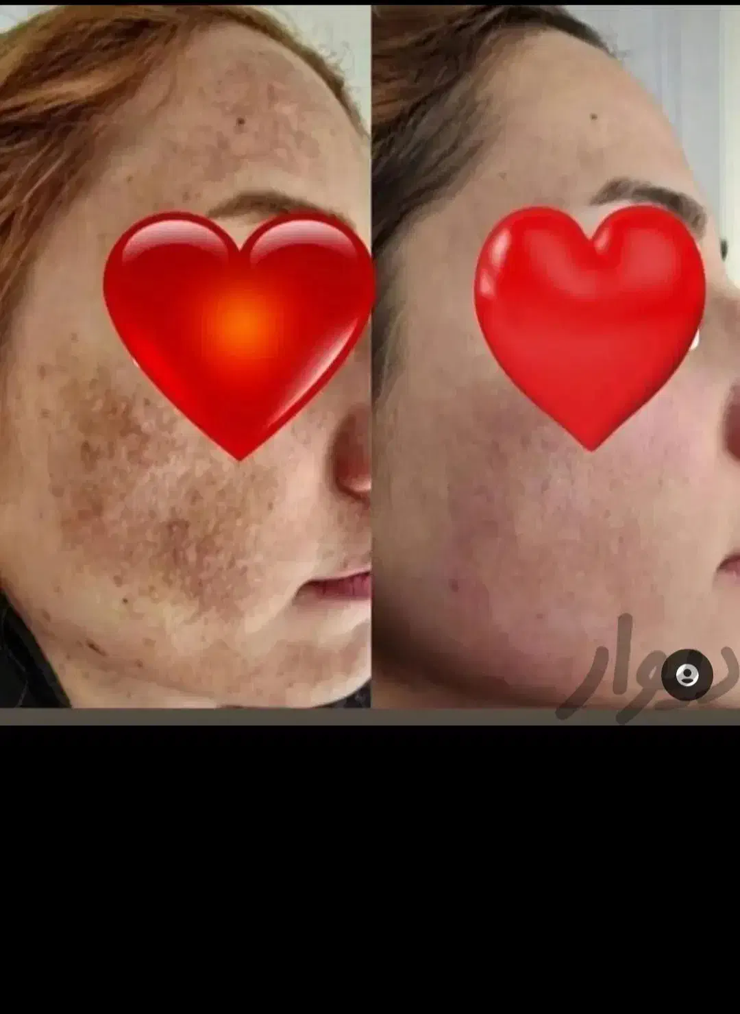 کرم سوپر معجزه صدرصد اصلی و ضمانتی|آرایشی، بهداشتی، درمانی|سنندج, |دیوار