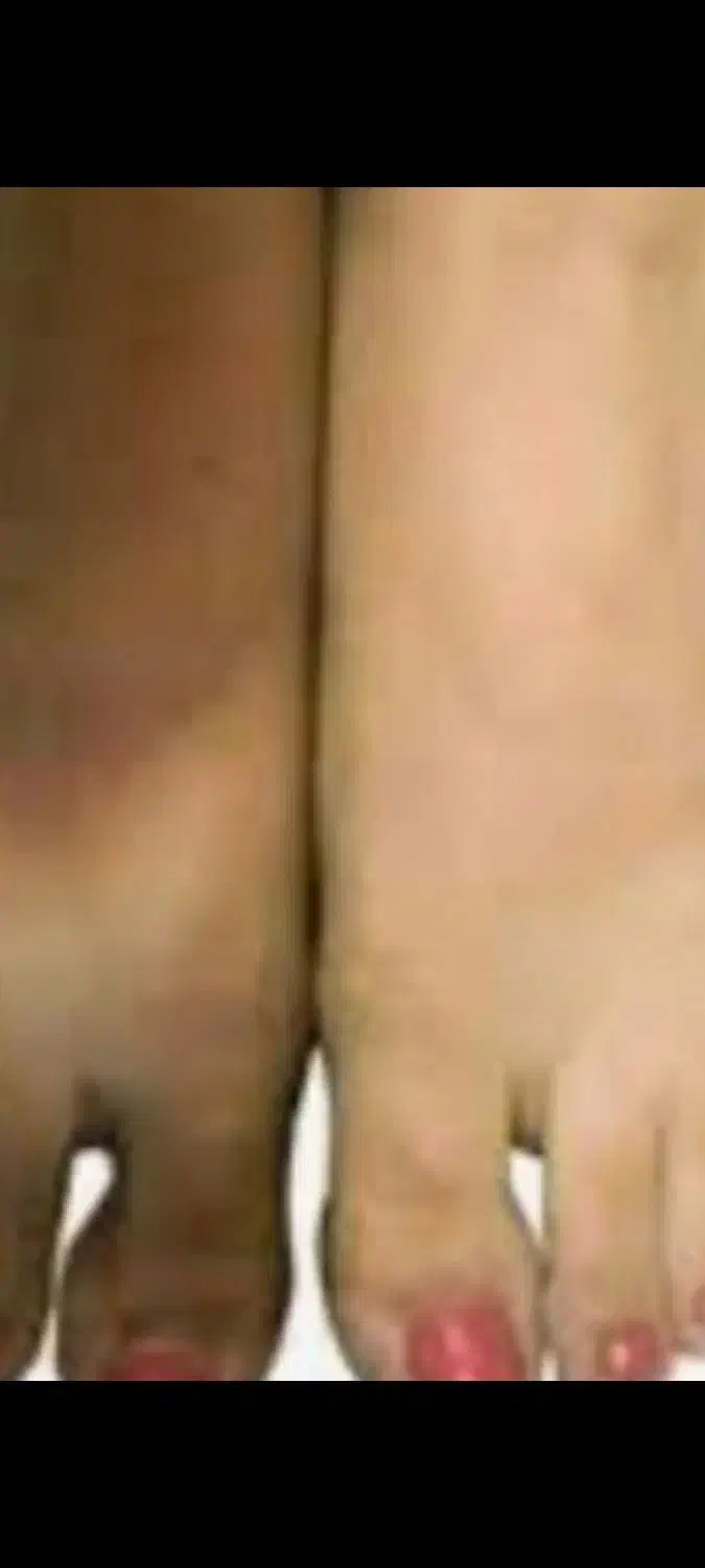 فرمول دست و پا و صورت|آرایشی، بهداشتی، درمانی|زابل, |دیوار