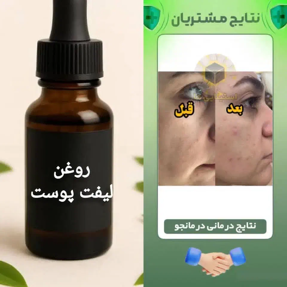 روغن تراپی|آرایشی، بهداشتی، درمانی|خرمآباد, |دیوار