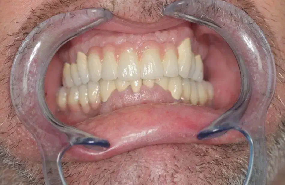 اقساط دندانپزشکی بدون پرداخت پول کلیه خدمات|خدمات آرایشگری و زیبایی|اصفهان, دشتستان|دیوار