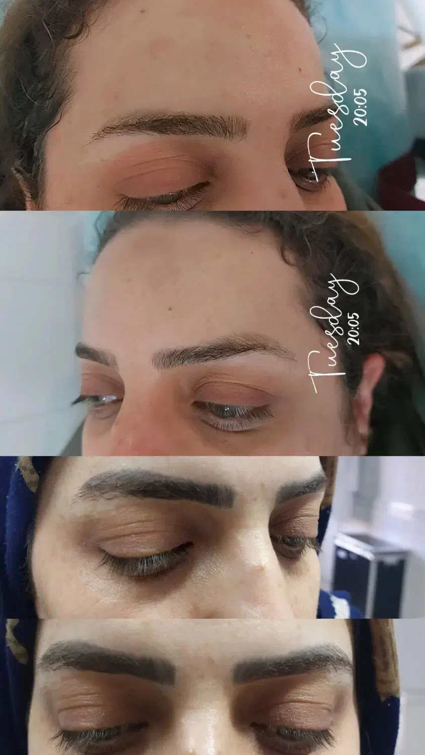 لیزرتتوابرو،لیزرهالیوودی کیوسوئیچ|خدمات آرایشگری و زیبایی|بروجرد, |دیوار