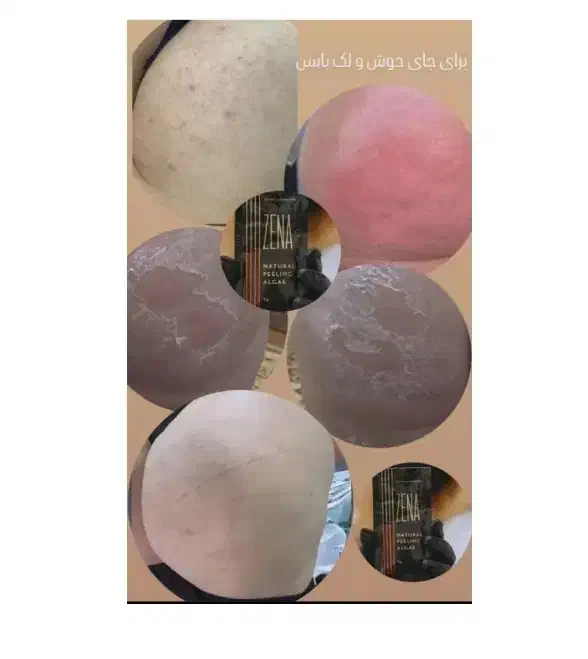 رفع تیرگی،آلگاپیل،لک صورت، پرسینگ، ژل صورت|خدمات آرایشگری و زیبایی|شیراز, سلطان آباد|دیوار