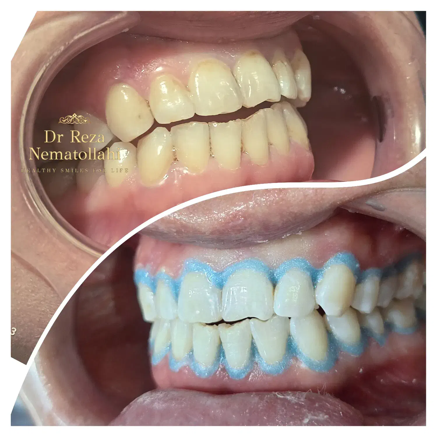 خدمات دندانپزشکی با بهترین کیفیت و پرداخت آسان|خدمات آرایشگری و زیبایی|اقلید, |دیوار