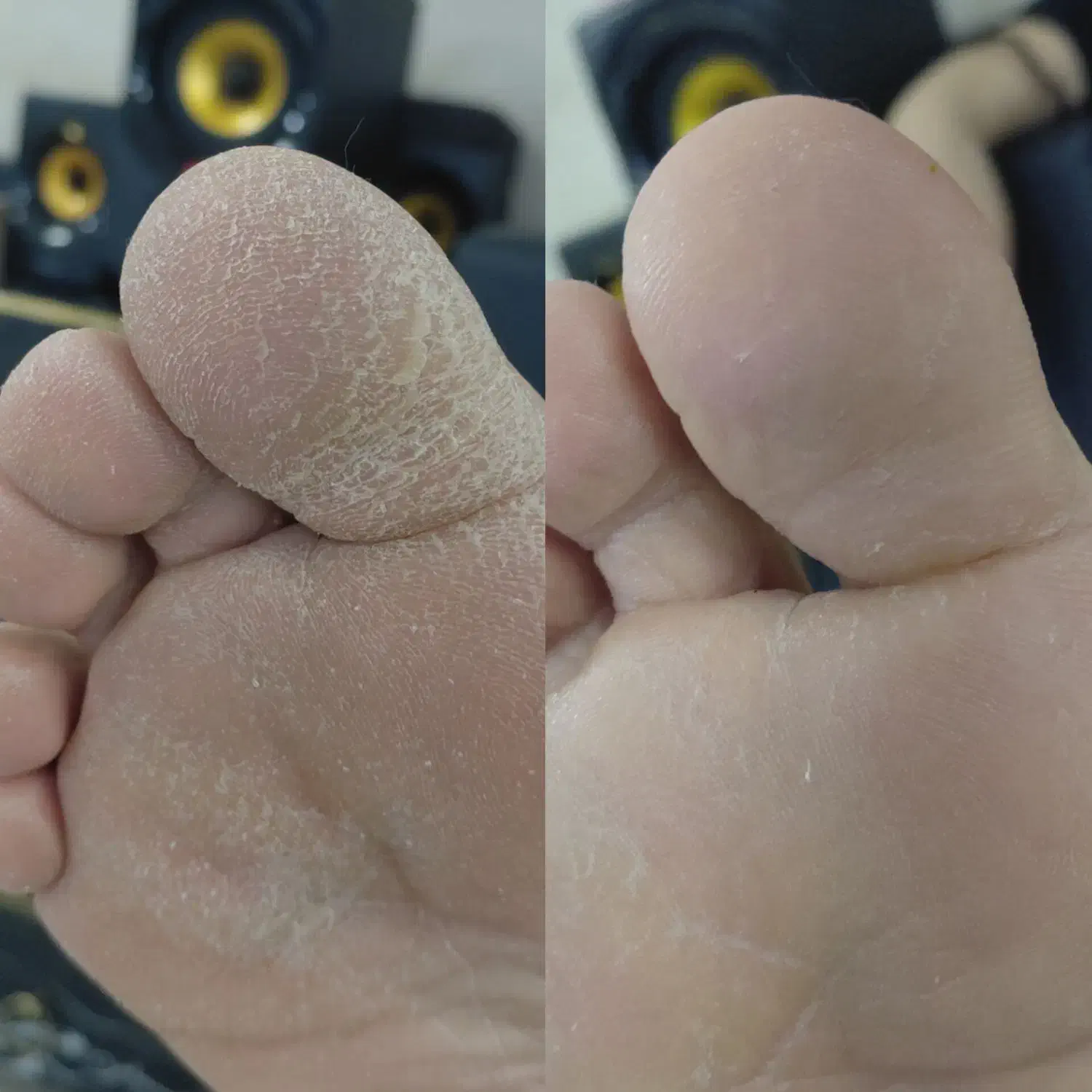 خدمات پدیکور|خدمات آرایشگری و زیبایی|گلپایگان, |دیوار