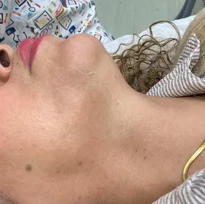 لیزر موهای زائد سفید و سیاه|خدمات آرایشگری و زیبایی|رشت, گلسار|دیوار