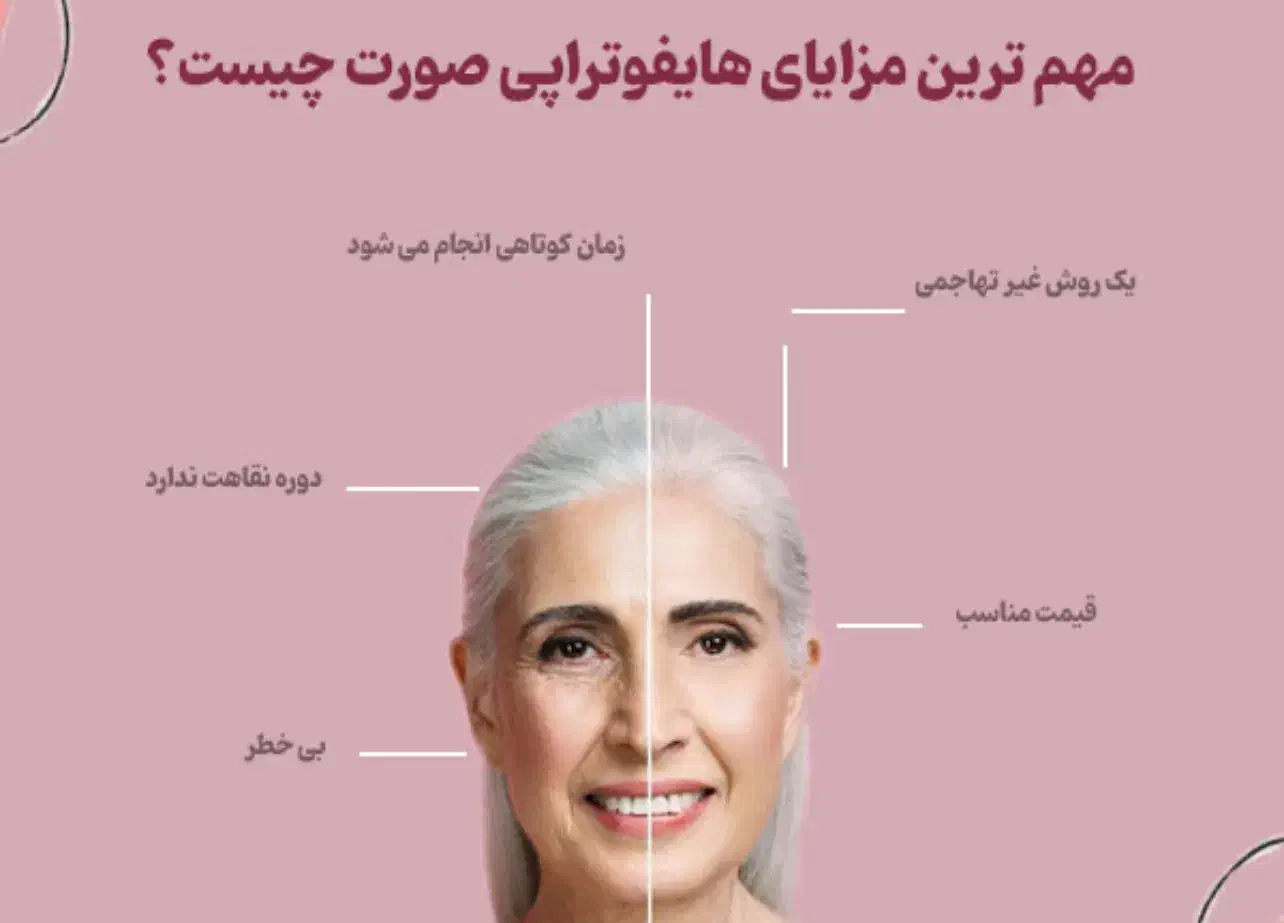 هایفو تراپی صورت شب یلدا|خدمات آرایشگری و زیبایی|سیرجان, |دیوار