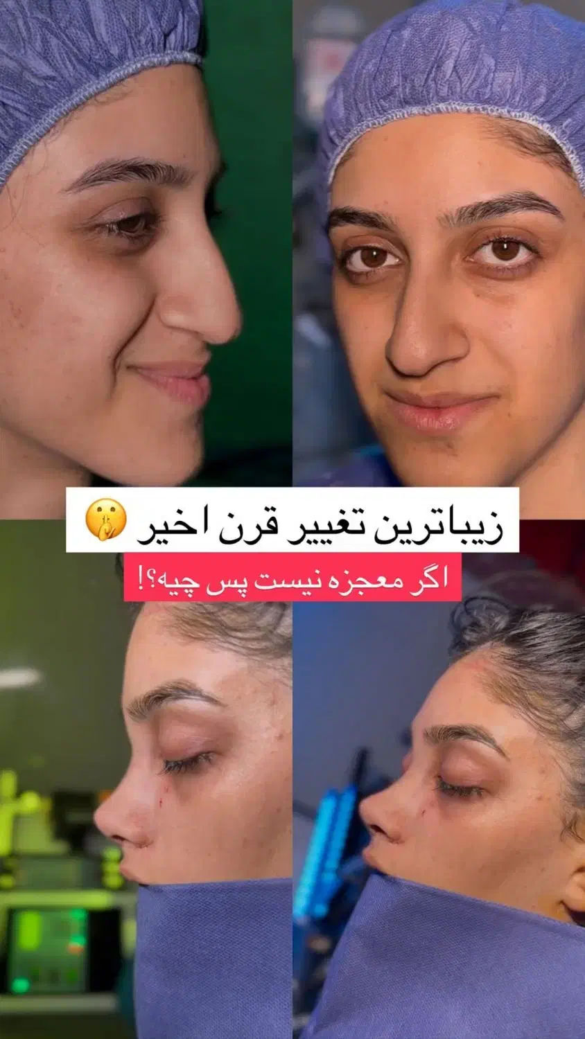 اف زیبایی بینی و لیپو|خدمات آرایشگری و زیبایی|اهواز, کیانپارس |دیوار