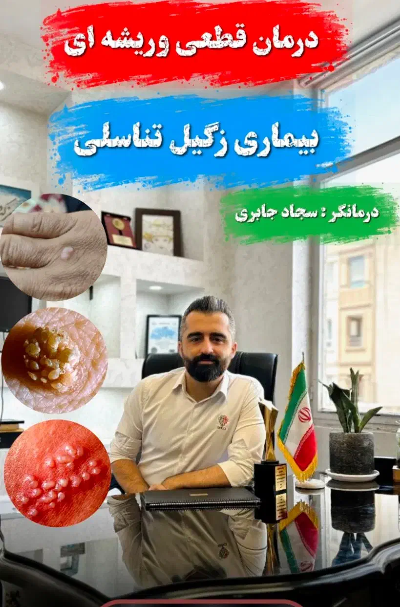درمان با تضمین زگیل و تبخال|خدمات آرایشگری و زیبایی|آمل, |دیوار