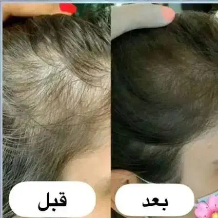 تونیک هیرفرند|آرایشی، بهداشتی، درمانی|اصفهان, ارداجی|دیوار