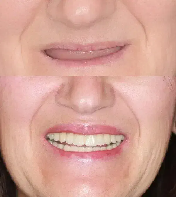 اقساط دندانپزشکی بدون پرداخت پول کلیه خدمات|خدمات آرایشگری و زیبایی|اصفهان, عطار نیشابوری|دیوار