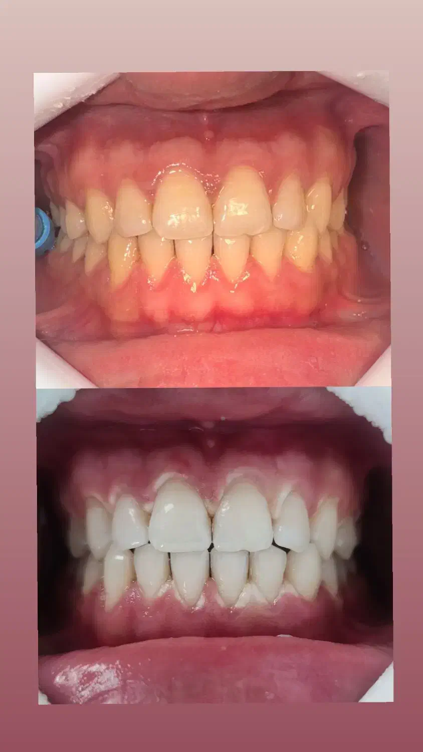 دندانپزشکی هرا ویزیت مشاوره رایگان|خدمات آرایشگری و زیبایی|اندیشه, اندیشه فاز ۳|دیوار