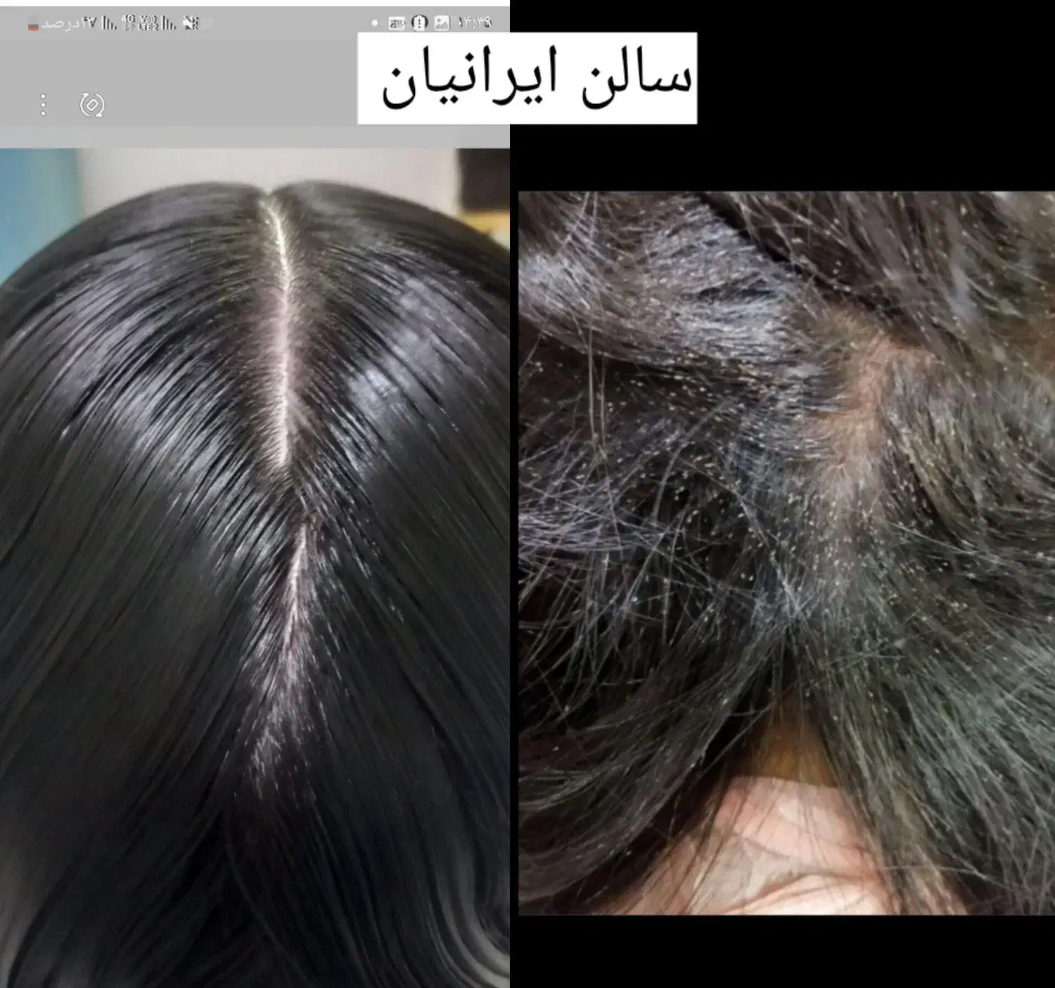 نیرو جهت کار دز سالن پاکسازی شپش|استخدام درمانی، زیبایی، بهداشتی|قم, علی آباد سعدگان|دیوار