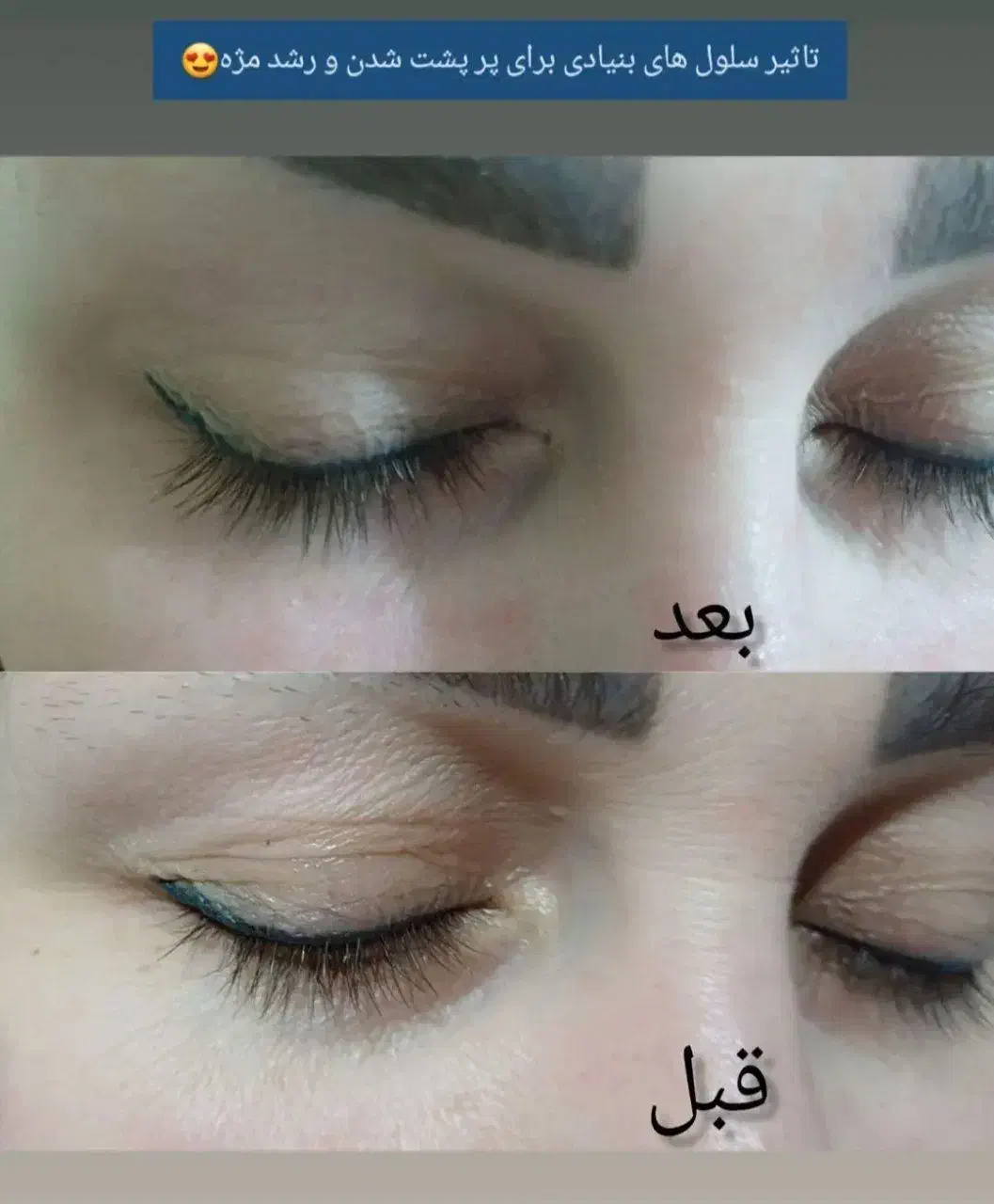 سفارش پکیج کامل صورت|آرایشی، بهداشتی، درمانی|شیراز, بازار|دیوار