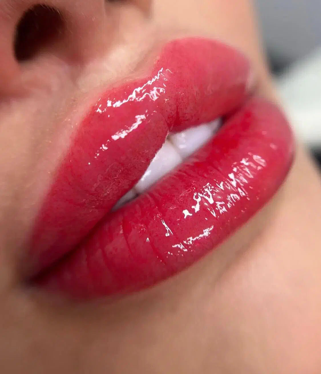 شیدینگ لب، درمان تیرگی لب (بدون درد)|خدمات آرایشگری و زیبایی|ساری, |دیوار