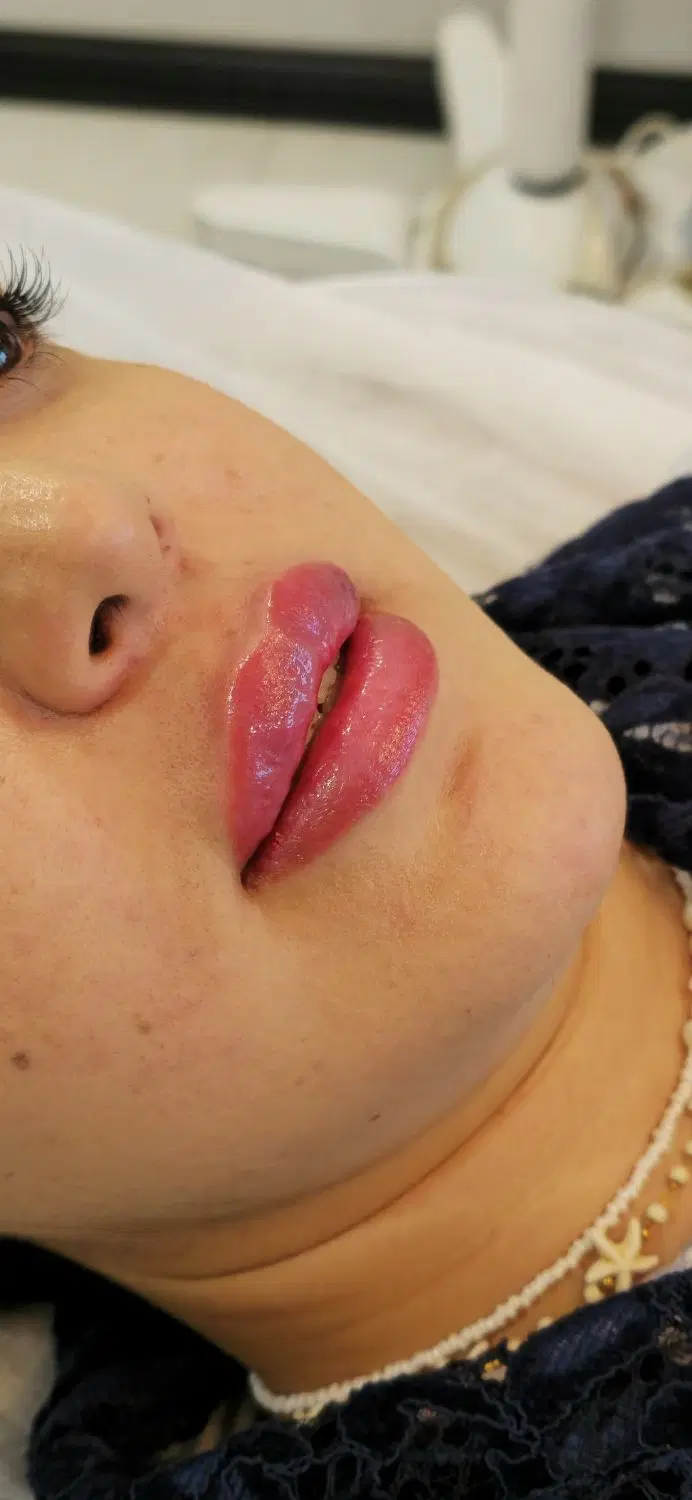تخفیفات ویژه بوتاکس، فیلر، ژل لب، prp توسط پزشک|خدمات زیبایی و سلامت|مشهد, احمدآباد|دیوار