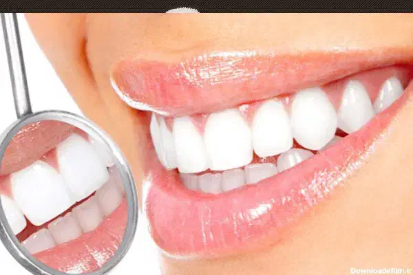 خدمات دندانپزشکی با بیمه ایران اسیا دانا نظر اباد|خدمات آرایشگری و زیبایی|نظرآباد, نظرآباد|دیوار