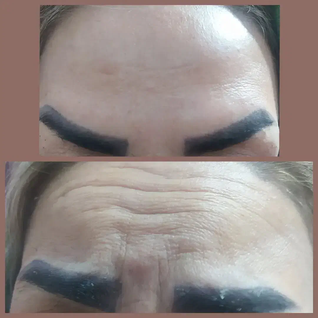 انجام خدمات ژل وبوتاکس حمیدیه|خدمات آرایشگری و زیبایی|حمیدیه, |دیوار