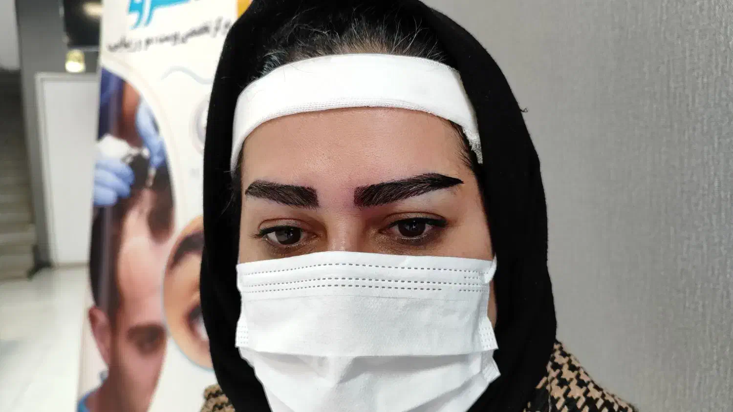 کاشت مو و ابرو در گلپایگان|خدمات آرایشگری و زیبایی|فریدونشهر, |دیوار