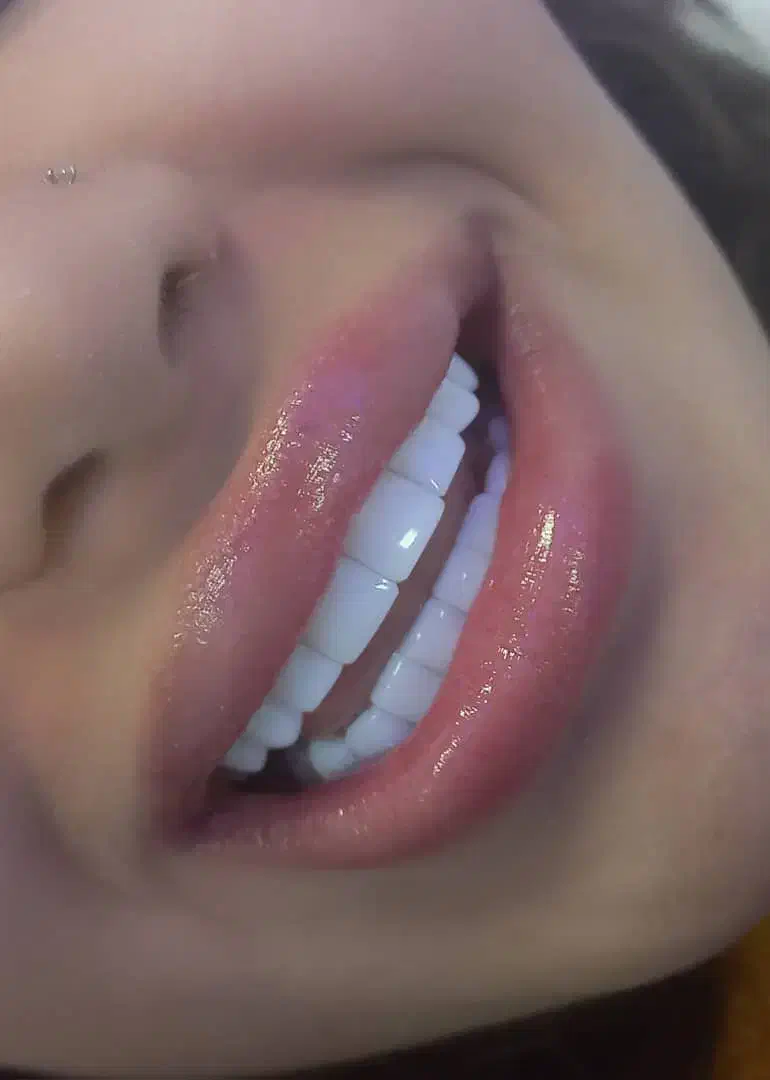 استخدام ویزیتور و بازاریاب کامپوزیت دندان|استخدام بازاریابی و فروش|یاسوج, |دیوار