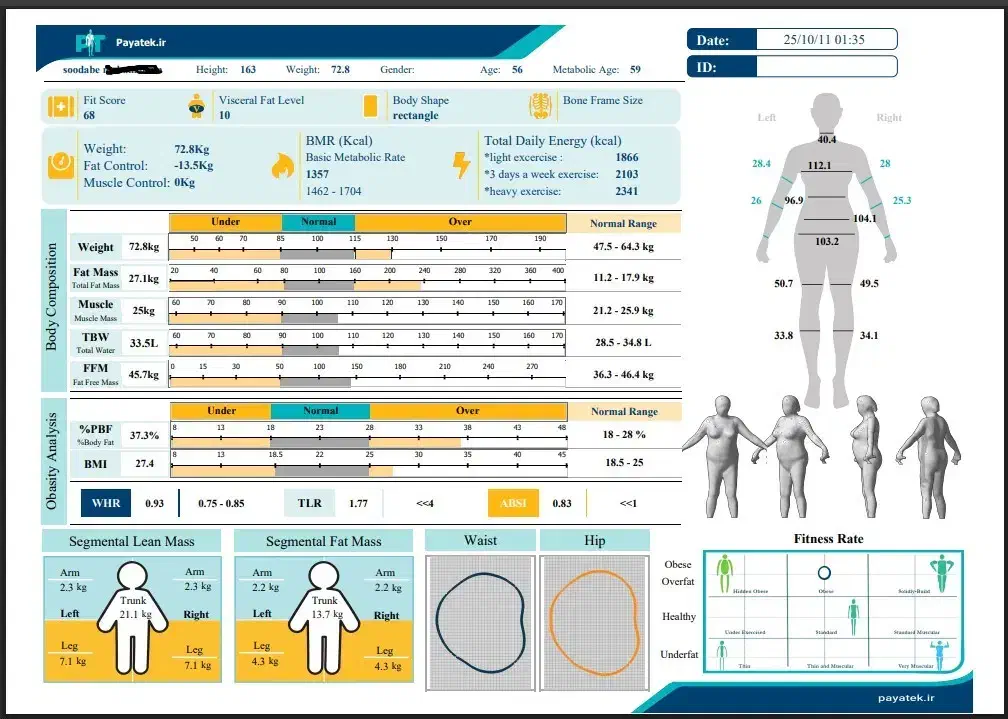 لاغری با دستگاه جلسه ای 150 هزارتومان(فقط تا۶ آذر)|خدمات آرایشگری و زیبایی|مشهد, دانشجو|دیوار