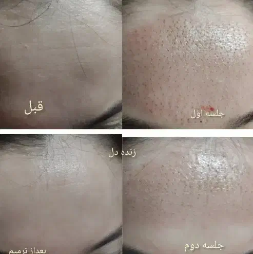 تخفیف روز مادر|آرایشی، بهداشتی، درمانی|مسجد سلیمان, |دیوار