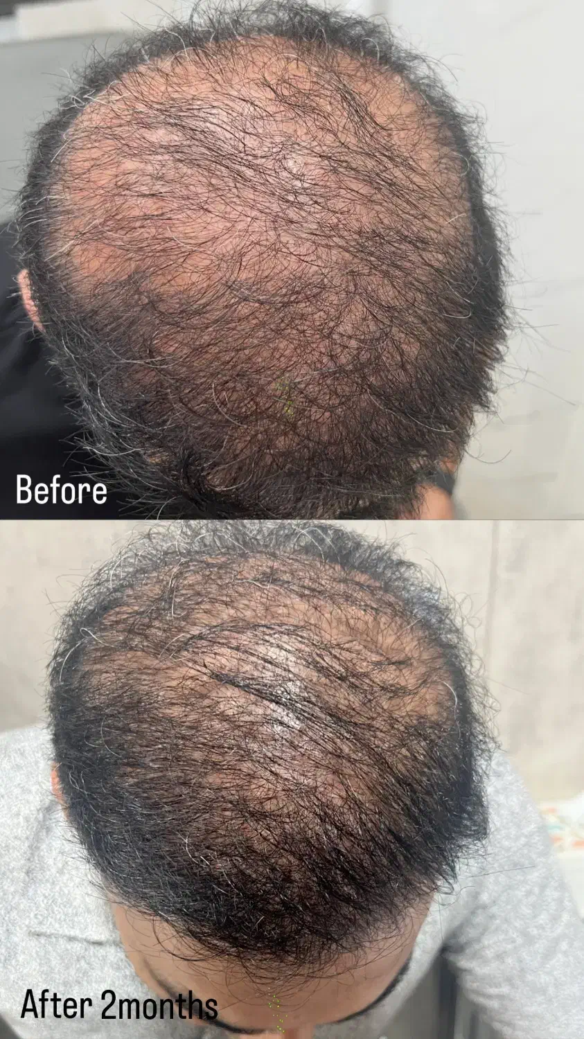 جشنواره پاییزی خدمات زیبایی|خدمات آرایشگری و زیبایی|بوشهر, |دیوار