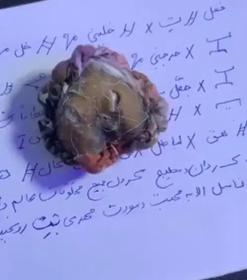 سونگ دهدشت|فعالیت داوطلبانه|دهدشت, |دیوار