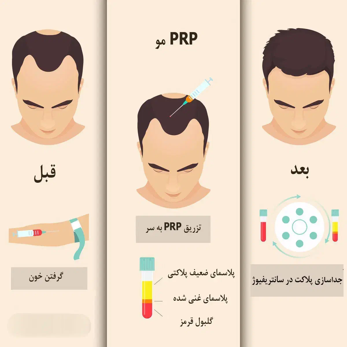prp مو|خدمات آرایشگری و زیبایی|تبریز, |دیوار
