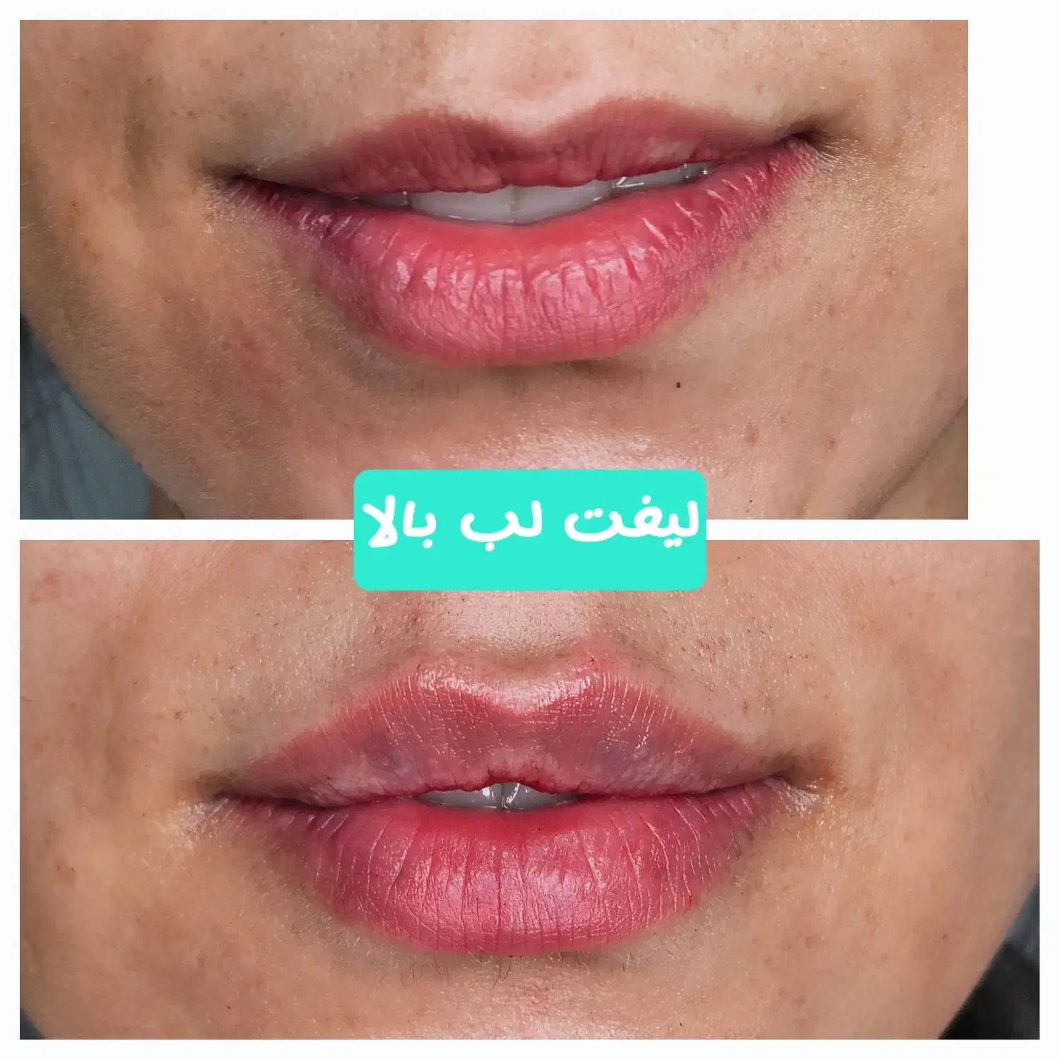 کلینیک زیبایی رز(رویال سابق)|خدمات آرایشگری و زیبایی|دورود, |دیوار