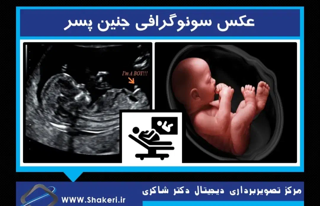 نوبت سونوگرافی کلینیک ولیعصر قیمت سونو 30تومن|فعالیت داوطلبانه|بیرجند, |دیوار