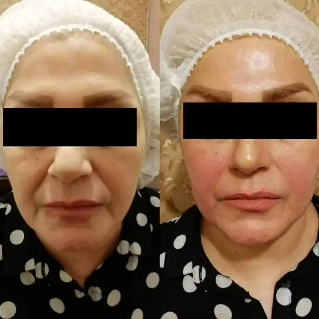 کلینیک تخصصی پوست ماهور (ستاره پوست(|خدمات آرایشگری و زیبایی|زابل, |دیوار