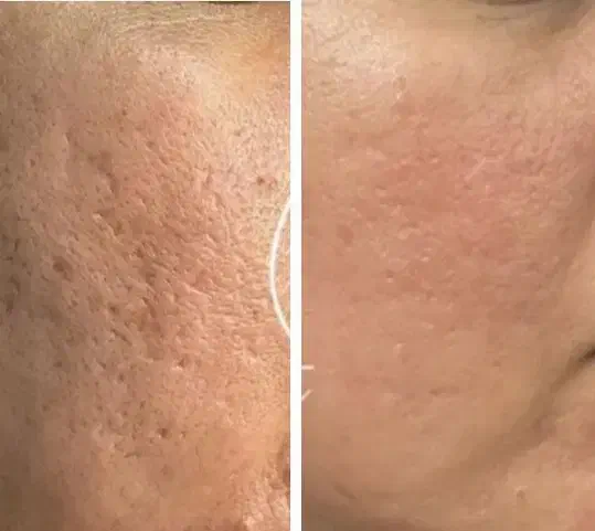 آموزش آلگاپیل (تکنیک پوست مار)|خدمات آموزشی|لنجان, |دیوار