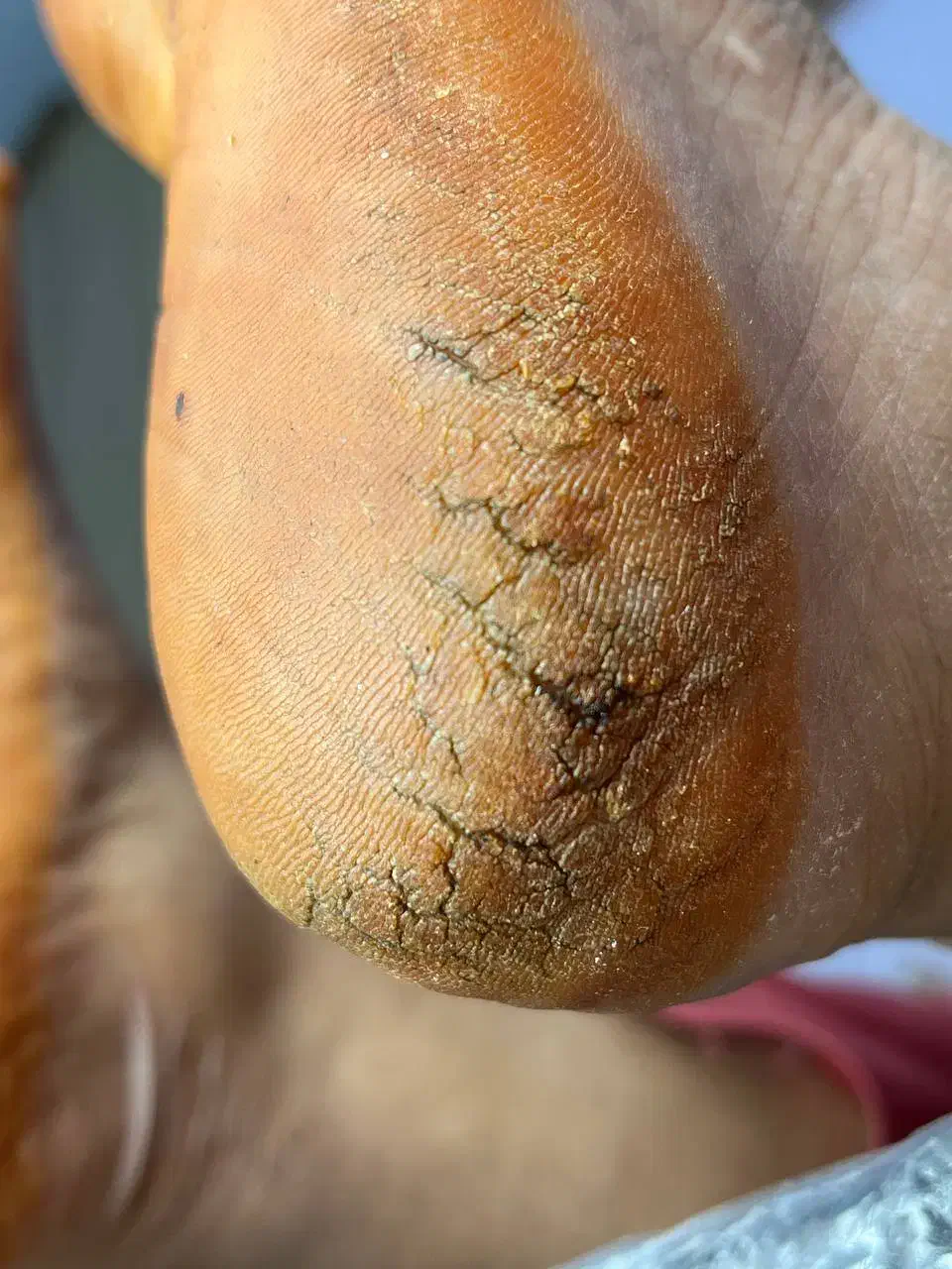 پدیکور پا ،رفع تیرگی ،قوزک پا|خدمات آرایشگری و زیبایی|پاکدشت, پاکدشت (مامازند)|دیوار